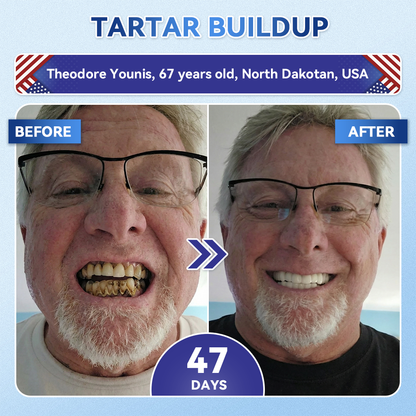 Your Smile~ SpringCherry® 🦷 Tideglusib Fast‑Dissolving Tooth & Gum Repair Oral Strips ✨ (𝟓-𝐢𝐧-𝟏 💎 𝐑𝐞𝐛𝐮𝐢𝐥𝐝 𝐄𝐧𝐚𝐦𝐞𝐥 & 𝐃𝐞𝐧𝐭𝐢𝐧 • 𝐒𝐭𝐫𝐞𝐧𝐠𝐭𝐡𝐞𝐧 𝐆𝐮𝐦𝐬 • 𝐄𝐫𝐚𝐝𝐢𝐜𝐚𝐭𝐞 𝐓𝐚𝐫𝐭𝐚𝐫 & 𝐎𝐝𝐨𝐫 • 𝐖𝐡𝐢𝐭𝐞𝐧𝐢𝐧𝐠 • 𝐒𝐭𝐨𝐩 𝐓𝐨𝐨𝐭𝐡 𝐒𝐞𝐧𝐬𝐢𝐭𝐢𝐯𝐢𝐭𝐲)