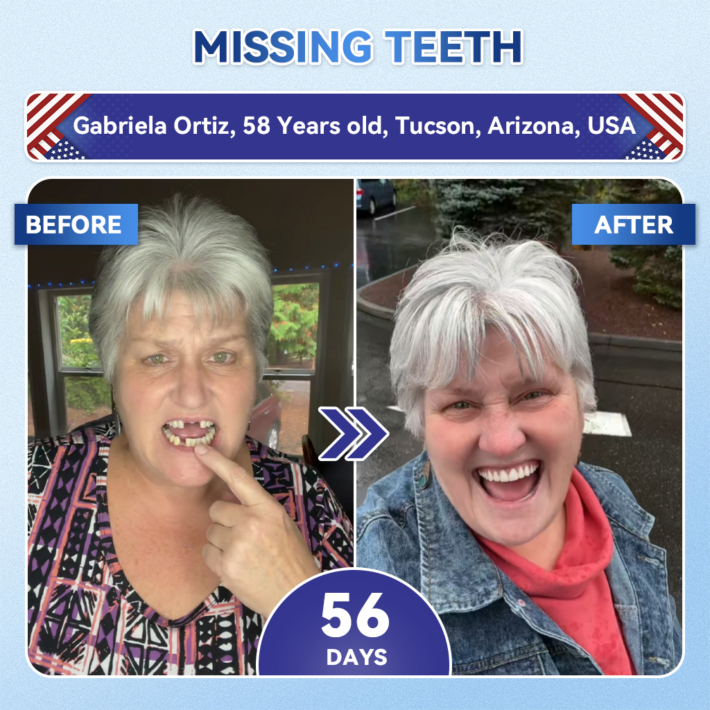 Your Smile~ SpringCherry® 🦷 Tideglusib Fast‑Dissolving Tooth & Gum Repair Oral Strips ✨ (𝟓-𝐢𝐧-𝟏 💎 𝐑𝐞𝐛𝐮𝐢𝐥𝐝 𝐄𝐧𝐚𝐦𝐞𝐥 & 𝐃𝐞𝐧𝐭𝐢𝐧 • 𝐒𝐭𝐫𝐞𝐧𝐠𝐭𝐡𝐞𝐧 𝐆𝐮𝐦𝐬 • 𝐄𝐫𝐚𝐝𝐢𝐜𝐚𝐭𝐞 𝐓𝐚𝐫𝐭𝐚𝐫 & 𝐎𝐝𝐨𝐫 • 𝐖𝐡𝐢𝐭𝐞𝐧𝐢𝐧𝐠 • 𝐒𝐭𝐨𝐩 𝐓𝐨𝐨𝐭𝐡 𝐒𝐞𝐧𝐬𝐢𝐭𝐢𝐯𝐢𝐭𝐲)