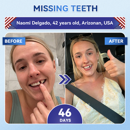 Your Smile~ SpringCherry® 🦷 Tideglusib Fast‑Dissolving Tooth & Gum Repair Oral Strips ✨ (𝟓-𝐢𝐧-𝟏 💎 𝐑𝐞𝐛𝐮𝐢𝐥𝐝 𝐄𝐧𝐚𝐦𝐞𝐥 & 𝐃𝐞𝐧𝐭𝐢𝐧 • 𝐒𝐭𝐫𝐞𝐧𝐠𝐭𝐡𝐞𝐧 𝐆𝐮𝐦𝐬 • 𝐄𝐫𝐚𝐝𝐢𝐜𝐚𝐭𝐞 𝐓𝐚𝐫𝐭𝐚𝐫 & 𝐎𝐝𝐨𝐫 • 𝐖𝐡𝐢𝐭𝐞𝐧𝐢𝐧𝐠 • 𝐒𝐭𝐨𝐩 𝐓𝐨𝐨𝐭𝐡 𝐒𝐞𝐧𝐬𝐢𝐭𝐢𝐯𝐢𝐭𝐲)