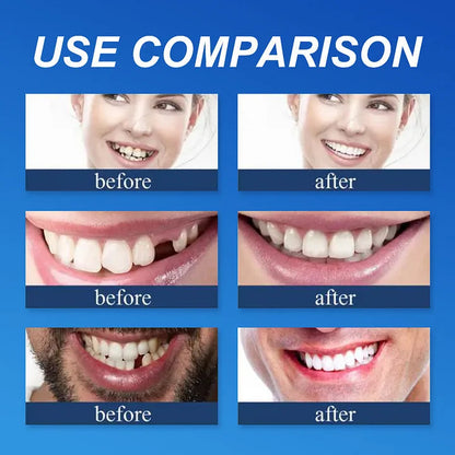 '--Ends Today: 75% OFF! ⏰DarkFairy™ Medical Full Denture with Strong Suctiond Custom-Fit Full Functional Dentures🦷